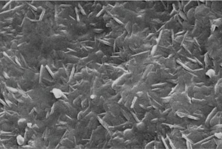 Microestructura cristalina reforzada en forma de placa.